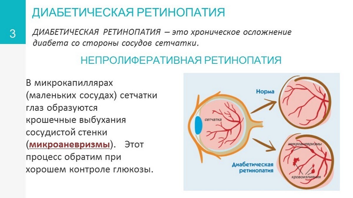 ослож3